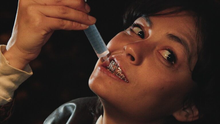 Woman with wired jaw. Liquid being injected into mouth. Lockjaw. Sabrina Greco.