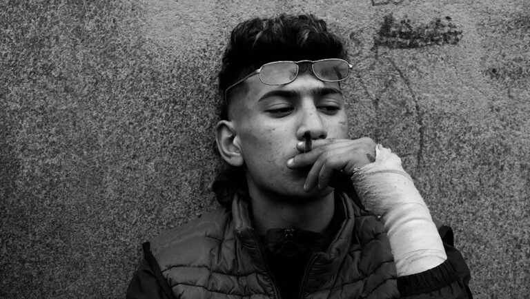Black and white portrait of a young man smoking. He wears glasses and a puffy vest, with his arm wrapped in bandages.